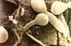 Candida albicans