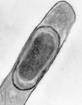 Bacillus lichenifomis 
