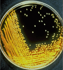 Vibrio cholerae growing on thiosulphate citrate bile salt sucrose (TCBS) agar pl