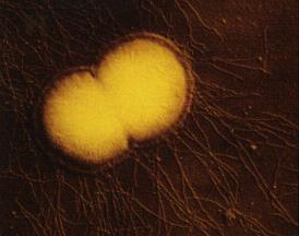 http://textbookofbacteriology.net/themicrobialworld/gonorrhea.html