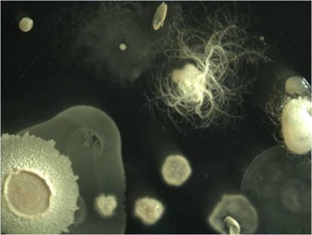 Soil microorganisms on agar plate