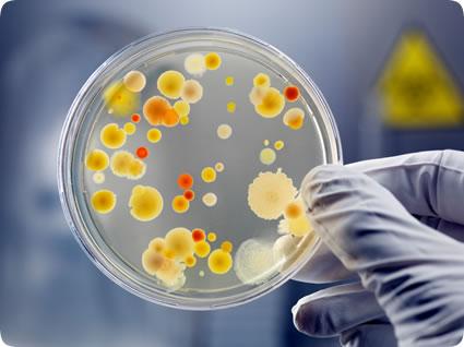 Pigmented bacterium colonies