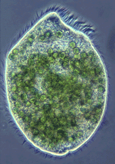 Ciliated Climacostomum sp.
