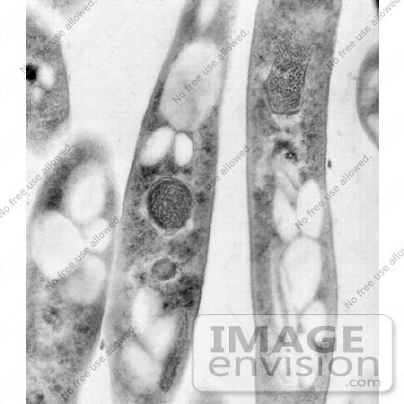 http://www.imageenvision.com/photo/5046-bacillus-anthracis-transmission-electron