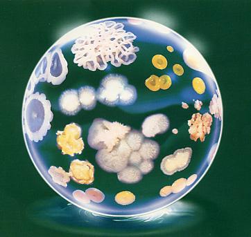 Different bacterium colonies on solid medium