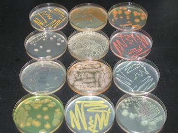 Pigmented bacterium and fungi colonies