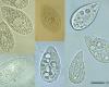 http://protist.i.hosei.ac.jp/taxonomy/ciliophora/oligohymenophorea/genus/tetrahy